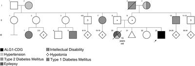 ALG1-CDG Caused by Non-functional Alternative Splicing Involving a Novel Pathogenic Complex Allele